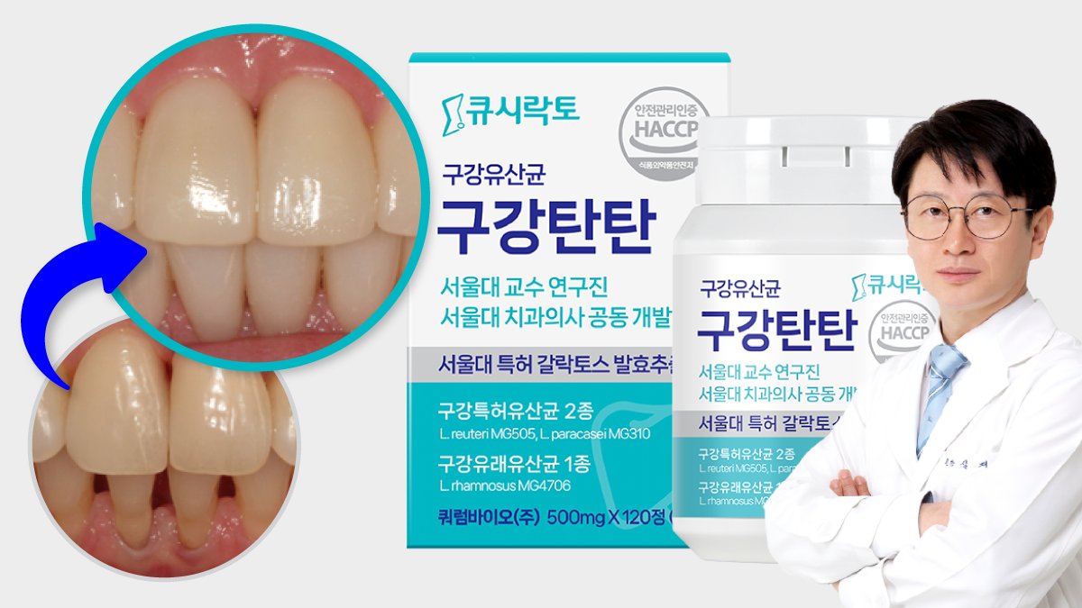 [쿠팡1위 구강유산균] 서울대 연구진 개발, 구강탄탄으로 잇몸/구취 해결