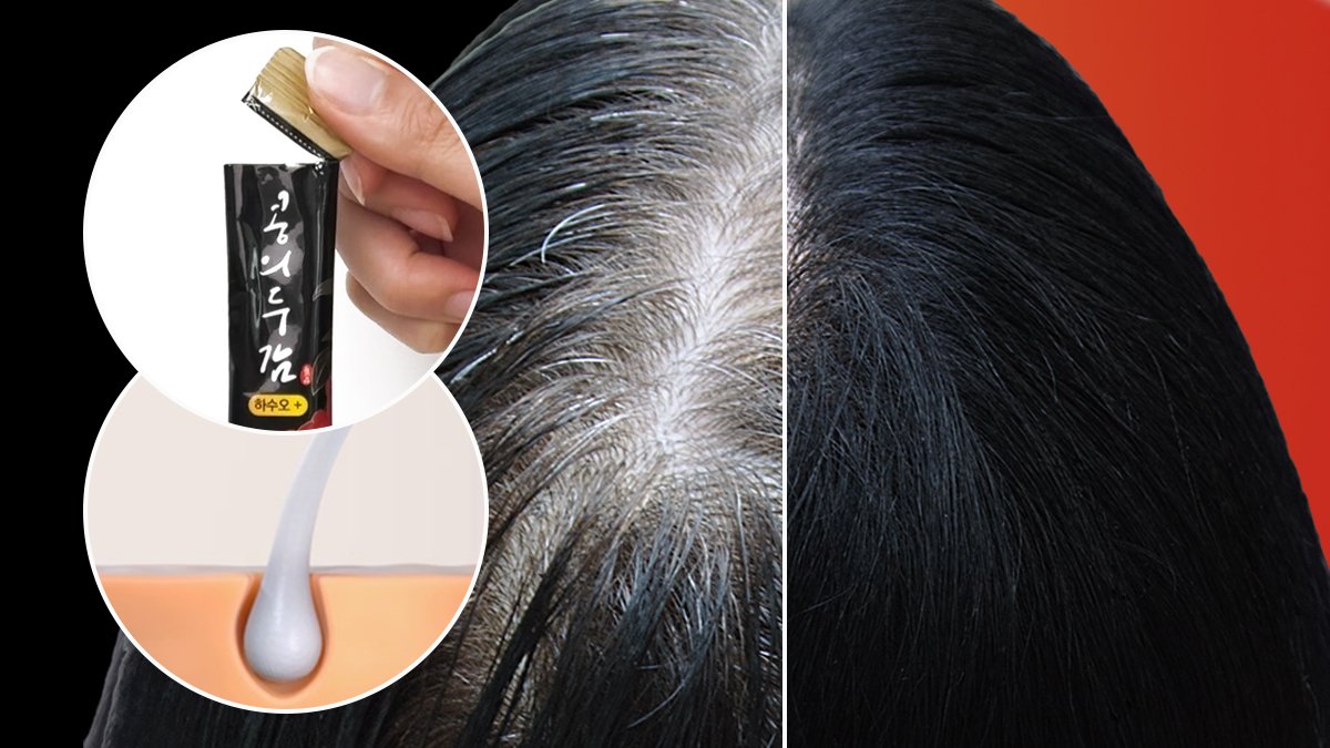 <白发逆转>脱发社区热议的何首乌究竟是什么？白发不再长出