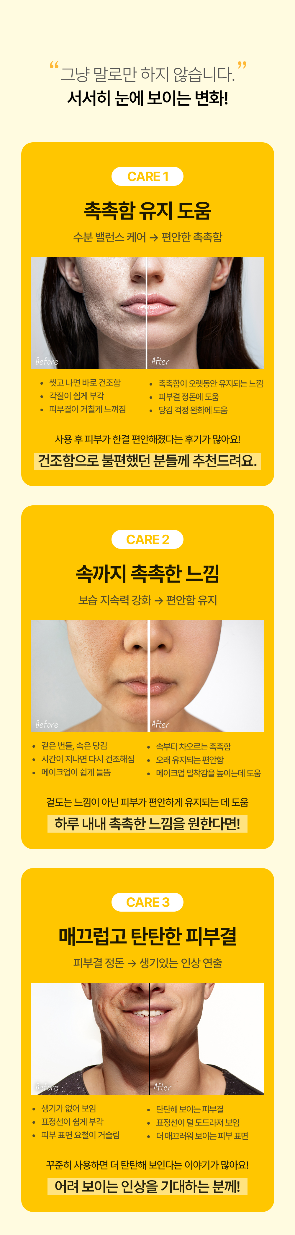 효과가 이정돈데 자극은 ZERO? 거짓말같은 앰플겔크림 하나로 스킨케어끝 by 빈데미아코스메틱 | 와디즈