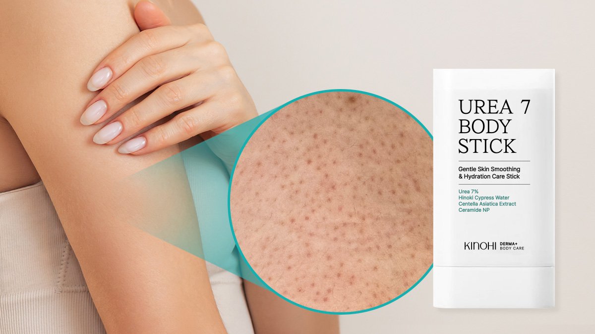 轻松实现鸡皮肌护理！一举解决干燥、角质、鸡皮肌问题的美体棒