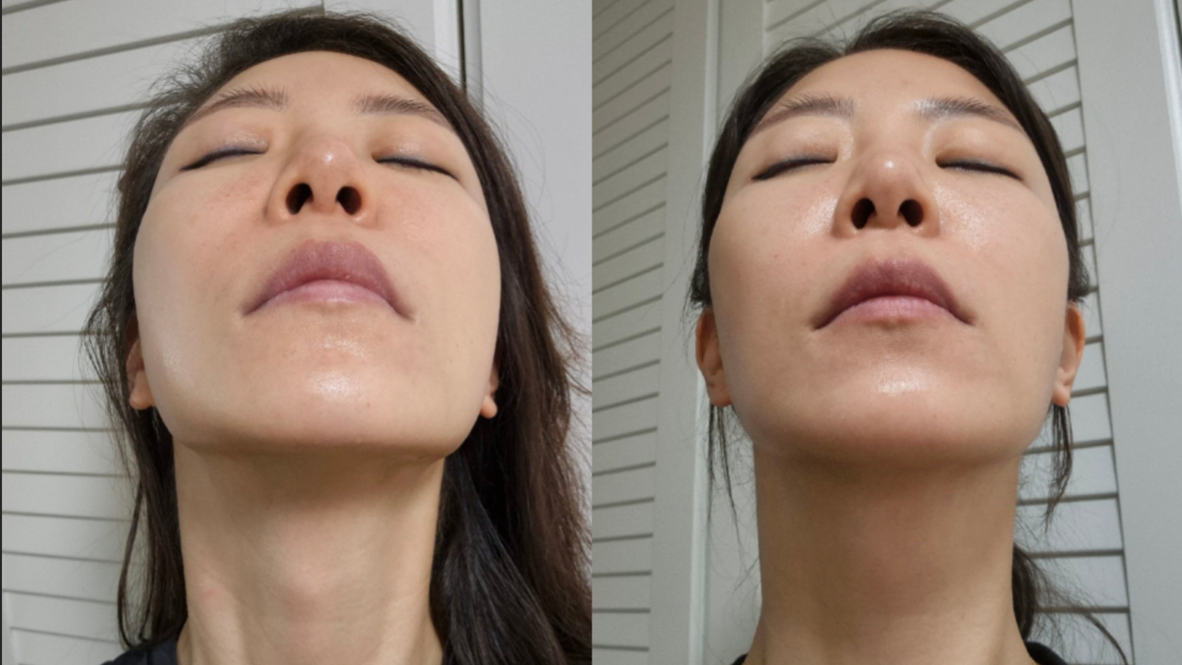 Just one pillow change l Solve asymmetry smile lines and neck wrinkles with Pillow Is Jinjamjal