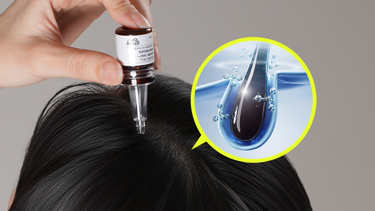 植发要花三千万？省下这笔钱吧。仅限头皮诊所院长专供的秘密原料