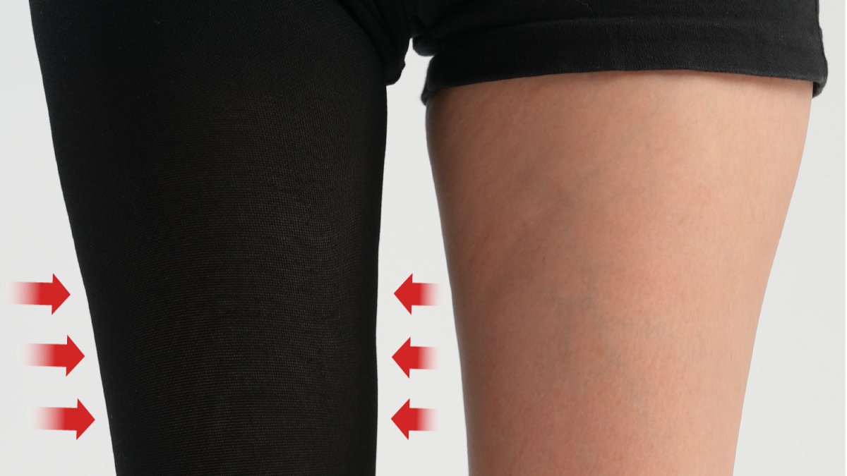 [Certified Medical Compression Stockings] Say goodbye to swollen legs ...