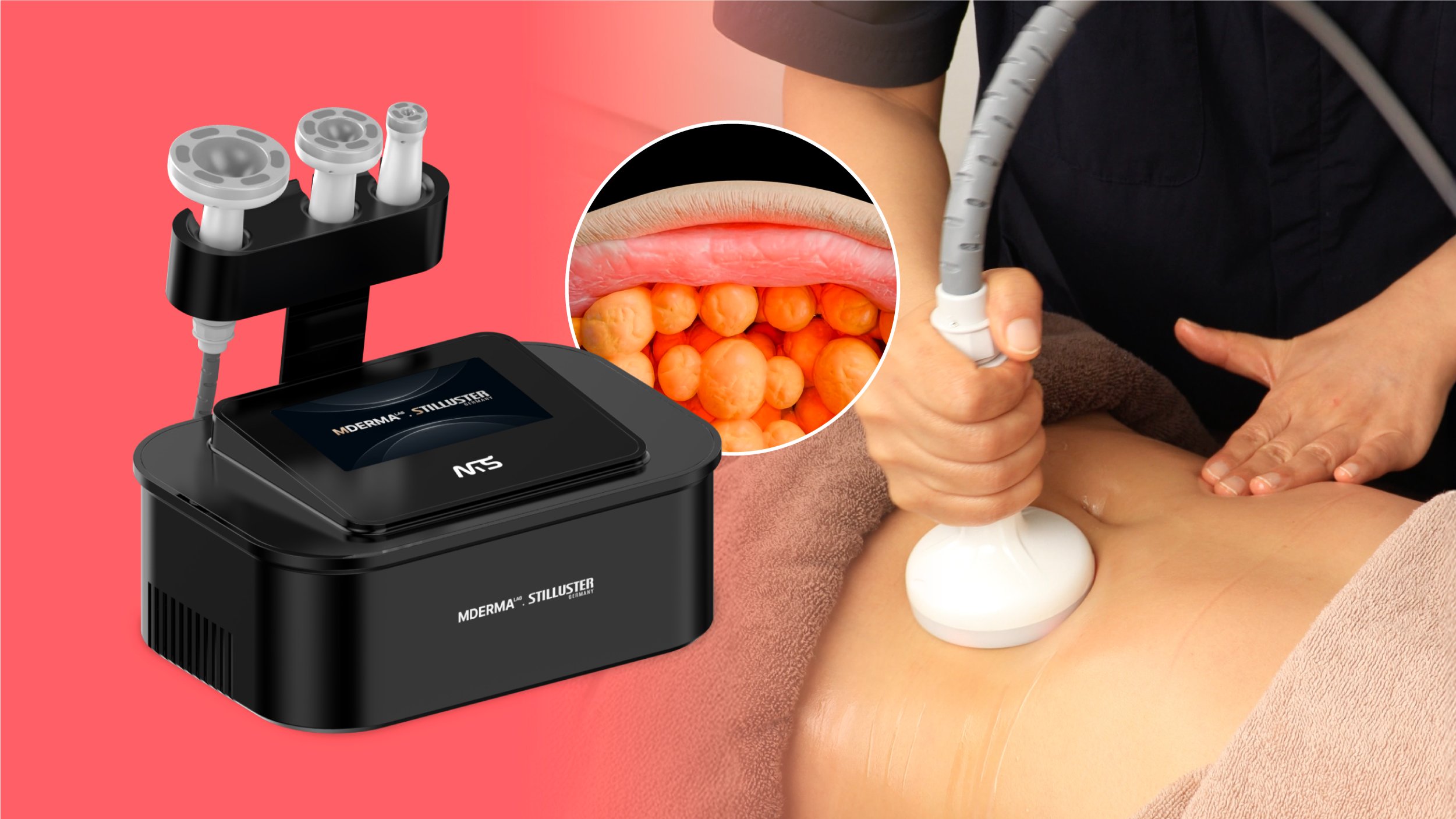 [청담美容院专用]全效溶脂模式｜无限脂肪吸引+射频技术