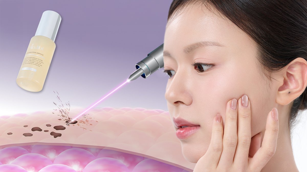 Remove everything but your charm | Clinically proven to clear acne scars dark spots and pores in 2 weeks