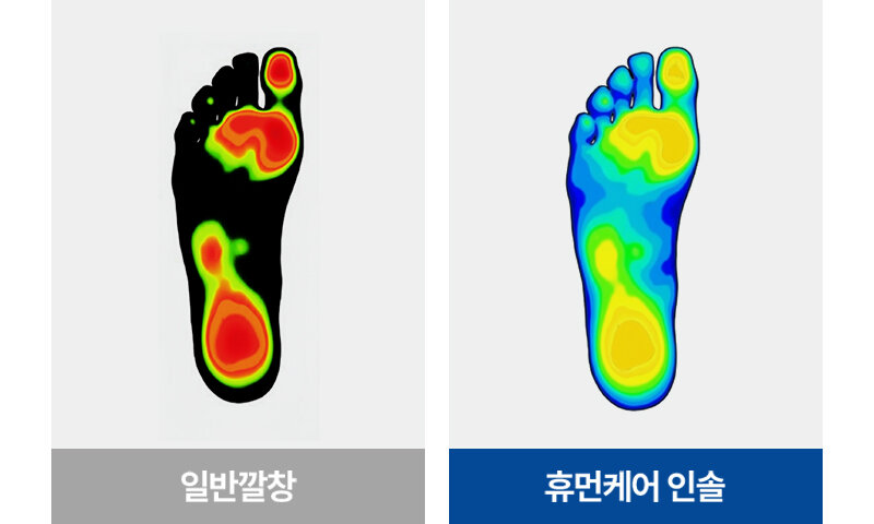 세상에 없던 내 발 모양에 맞게 변하는 형상기억 깔창 by 케이비아이 주식회사