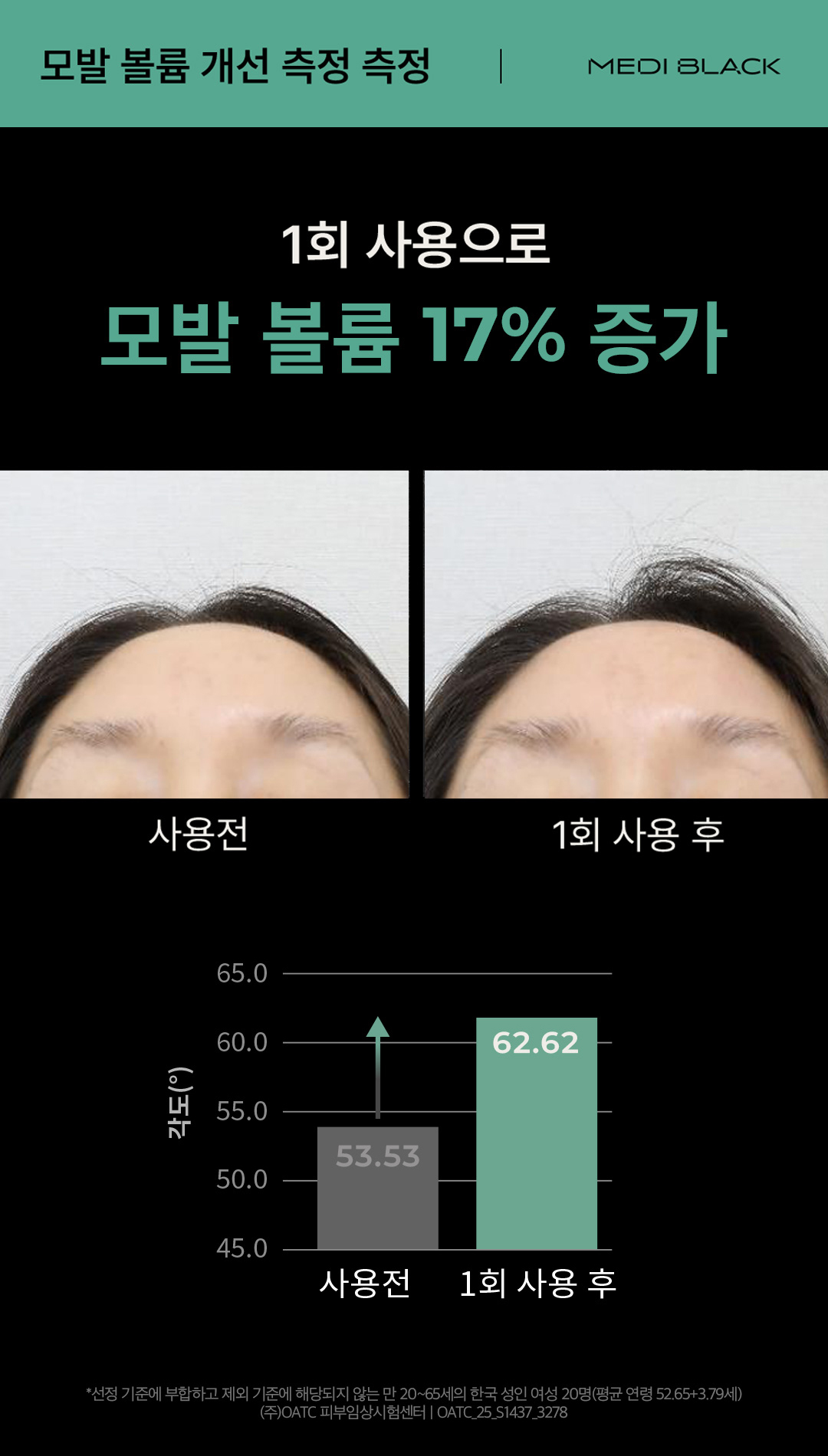 와디즈-메디블랙-이벤트1-6.jpg