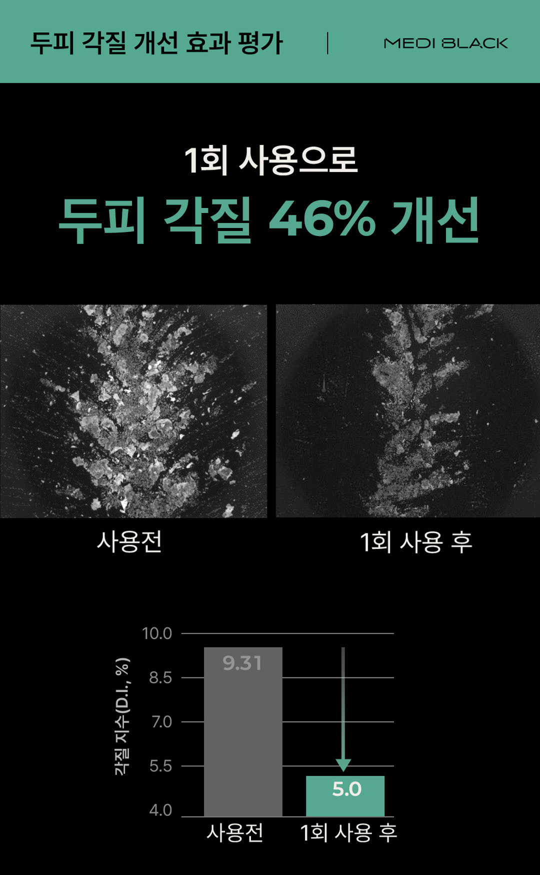 와디즈-메디블랙-이벤트1-5.jpg