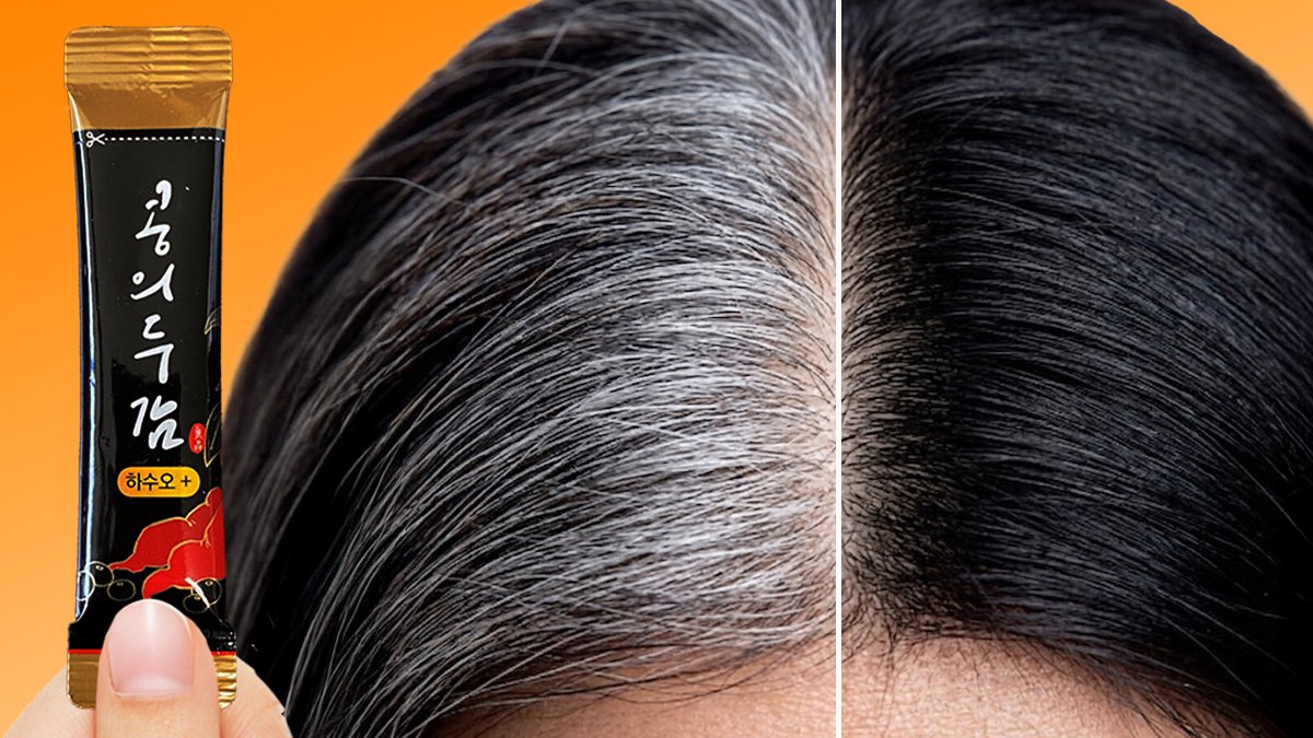<Gray Hair Solution> #1 Hit The Hsuso Root Craze Taking Hair Loss Communities by Storm