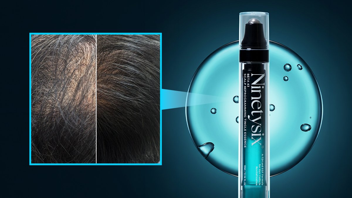 80 Million Won Worth Ingredients in a Hair Loss Ampoule? Exclusive First Launch by POSTECH Beta43 on Wadiz!