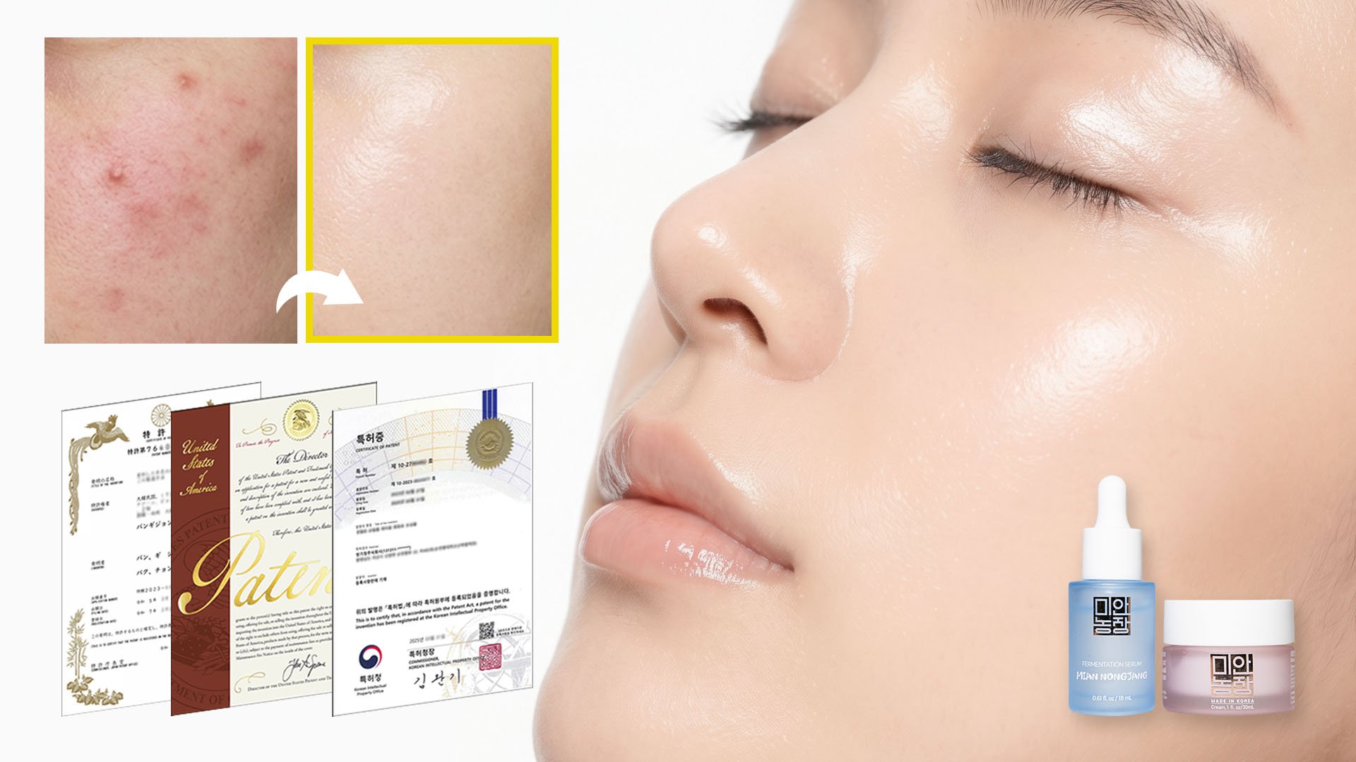 천년 전 고려의 피부 과학, 3개국 특허로 과학이 증명해낸 면지 바이옴!