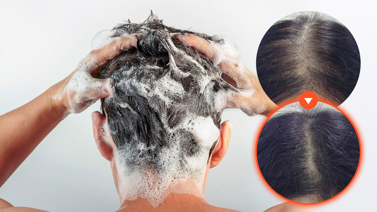 Wadiz No.1 GrowCell Hair Loss Shampoo—Limited Encore for Hair Fall Relief Even from Colds!