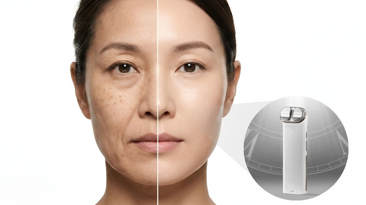 귀족수술 대신 슥- 문지르세요! 얼굴 위 깊은 주름 펴주는 팔자 다리미