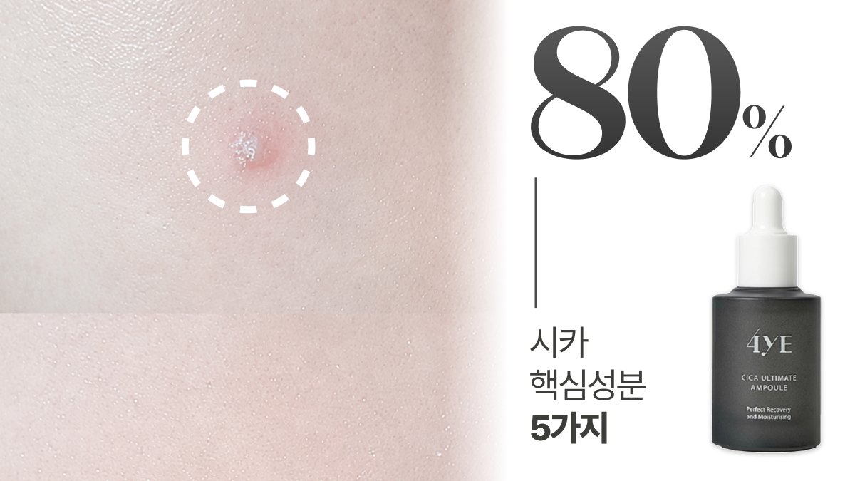 여자들의 평생고민! 그날의 피부 트러블  잡아드립니다. 그날의 앰플