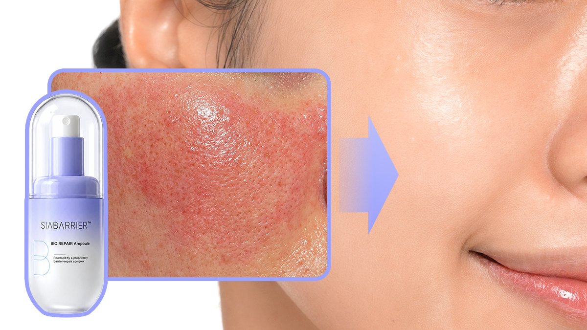 🚨Don’t waste millions on treatments! AI Heat Sensor Ampoule boosts damage barrier by 88%
